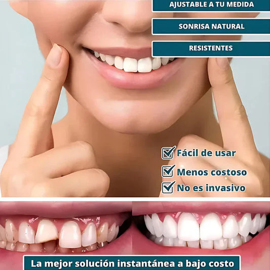 SmilePro 🦷 - Carillas Dentales Ajustables De Resina  Estéticas Snapon Smile - ¡Últimas unidades!