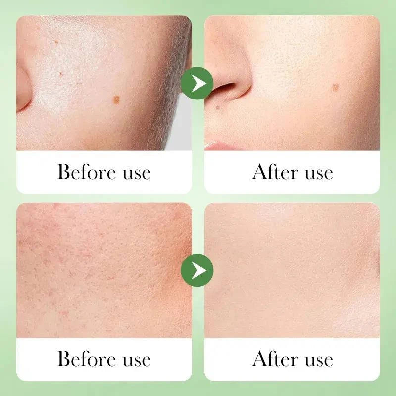 Loción facial Centella Asiática